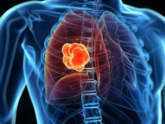 ��ͬ���͵ķΰ�Ҫ��ȡ��ͬ�����Ʒΰ��ķ���