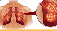 �����ڷΰ����߶����������Ԥ���ΰ�����