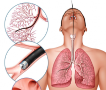 ����Щ��Ч�ķ�������Ԥ���ΰ�����