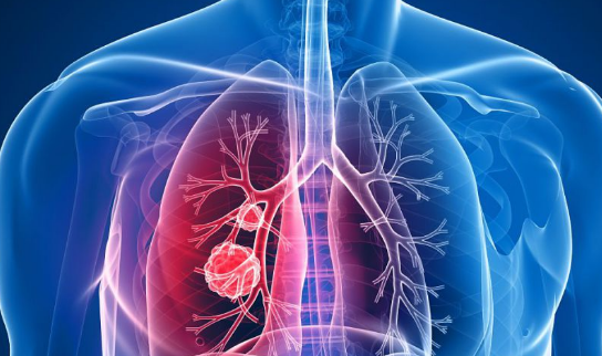 ������ΰ���ϵ