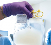 ϸ�������ͷ��ۺ���(CRS)�ǿ��ܳ��ֵ�CAR-T�Ʒ�������