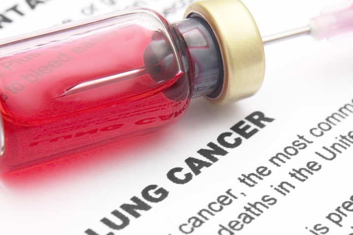 �ΰ����ڻ���