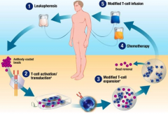 CAR-Tϸ���Ʒ��������Ҫ�������