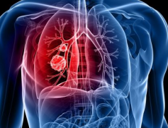 ���ڵķΰ���ת��֢״����Щ