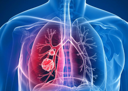 �ΰ����ڻᴫȾ��