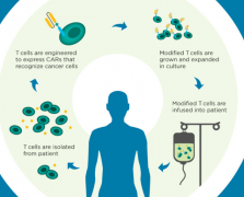 CAR-Tϸ��������ָǶ�Ͽ�ԭ����Tϸ�������Ʒ�