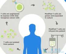 Ԥ��CAR-T�Ի��ߵ���Ч��CAR-T���ٵ�����