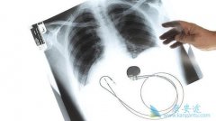 �ΰ���ת�Ʒ����ǻ����������ڷ�Сϸ���ΰ�����ѡ����