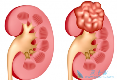 ����Щ�Ƚϳ�������������֢״