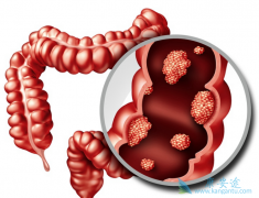 ���ڴ󳦰�֢״�����������ڳ�θ��������