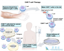 ���������İ�������CAR-T�е�ѡ������˾޴��Ӱ��