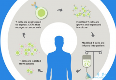 2017��FDA��׼�˵�һ����԰�֢�Ļ����Ʒ�CAR-T�Ʒ�