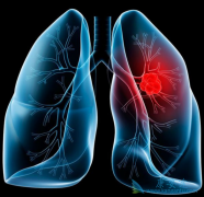 ���Ʒΰ��ķ������ݷ��ڲ�ͬ���в���