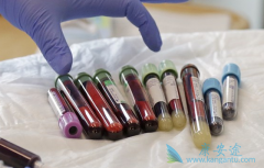 ��������CAR-Tϸ�����Ʋ�Ʒ��FDA��׼����