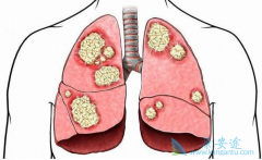 ���˷ΰ���ô�������Բ��������������Ҫ    