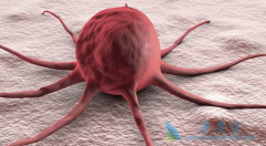 ͨ����CAR-Tҩ�����ͻ�������Ʒ�������