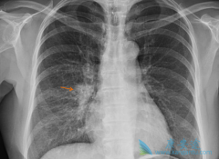 �������ϰ������ƶԷ�Сϸ���ΰ���ת��������Ч��