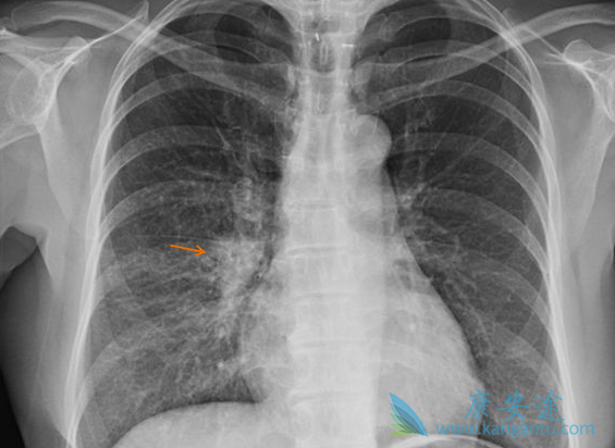 ��Сϸ���ΰ�