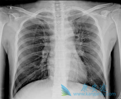 ���ڷΰ�����