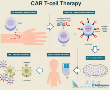 CAR-T�Ʒ�Kymriah���������ܰ���