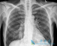 Сϸ���ΰ���������N3�ܰͽ�����������ھ���