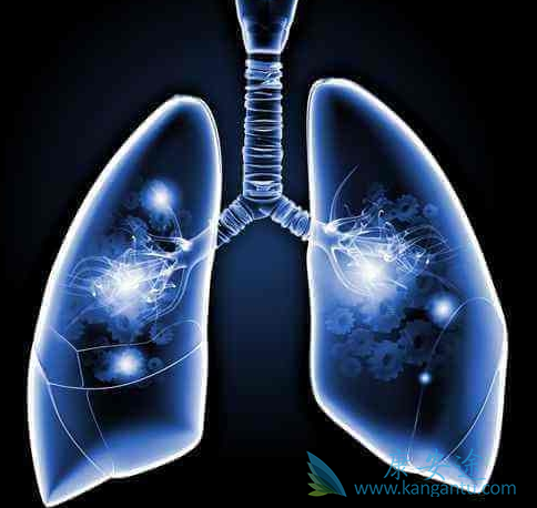 �ΰ������ܻ���