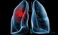 ��ҽ���Ʒΰ��ڻ���֢״�ӳ������ڷ����кܺõ�Ч��