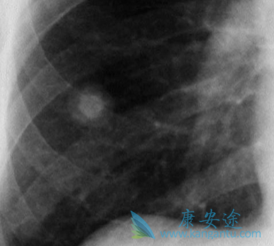 �ΰ����κ���