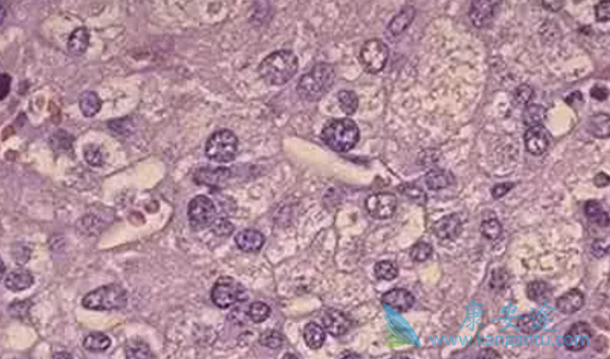 �ΰ�������ǰ