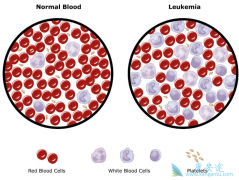 �����ܰ�ϸ����Ѫ������ʹ��CAR-Tϸ�����Ʒ�����