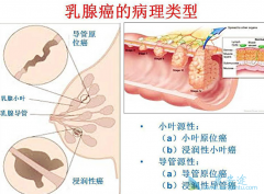 �������ٰ�֢״������Ƥ���ı������֢״