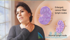 �����ܰ���֢״���ð��֢�ȼ�������