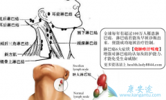 ����͵������ܰͰ�֢״��ȫ���ܰͽ��״�