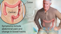 ����ֱ����֢״�����Եı��־��Ǹ�к�����