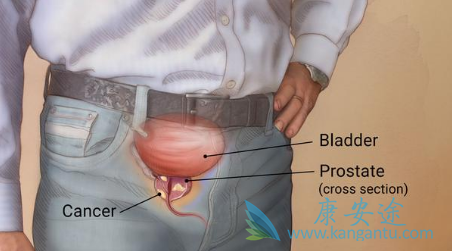 ǰ���ٰ�֢״