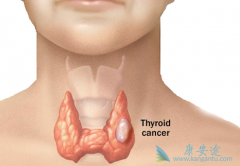 ���ڼ�״�ٰ�֢״�о����״��