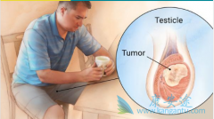 ����غ����ʹ�����������غ�谩֢״֮һ