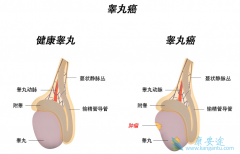 �G���ʵؼ�ӲҲ�п�����غ�谩֢״