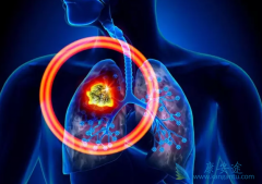 �չ˷ΰ�����Ҳ�ð�����Ϊ���ڷΰ��ᴫȾ��