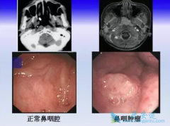 ���ʰ�֢״��������֢״�����辯��