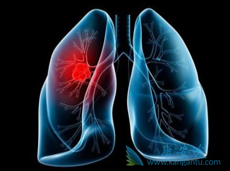 �ΰ�������ʳ