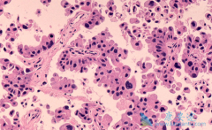 ��Сϸ���ΰ��ٰ�����������������ս