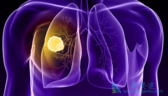 ��Сϸ���ΰ��������ƵĶ��߲���