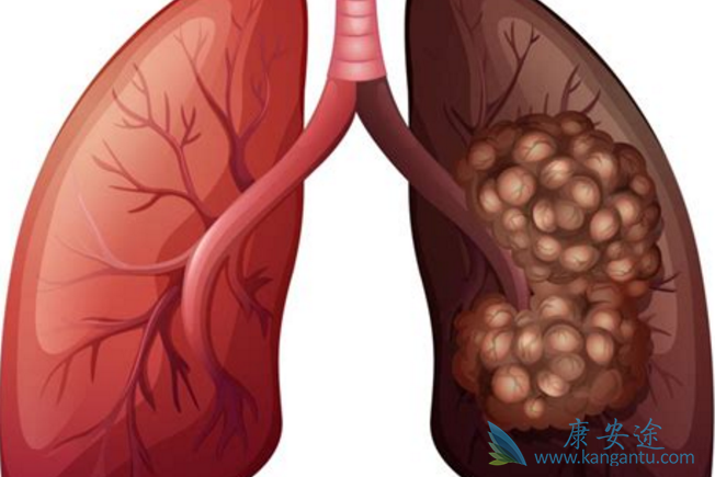 ���ڷΰ�������