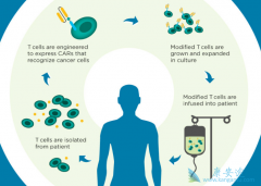 CAR-Tϸ���Ʒ���һ�����͵Ķ���ѪҺ�������ֶ�