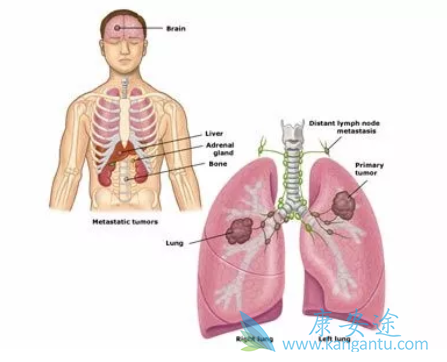 �ΰ����ڻᴫȾ��