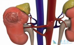 ������������ֵ��Ͳ�֢����������֢״