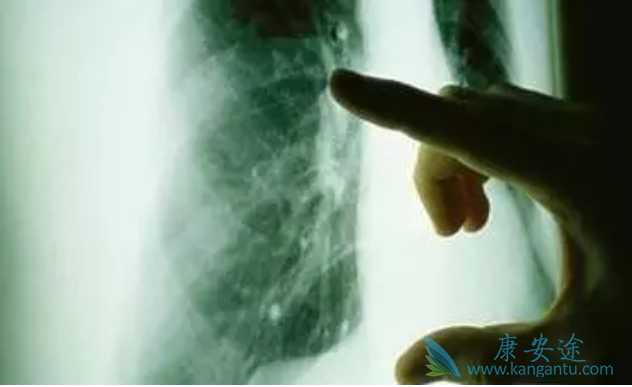 ��Сϸ���ΰ�