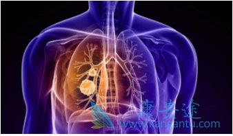 �ΰ��������ö���