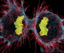 ���˰�֢��ô������֮�䰩֢���Ŵ���